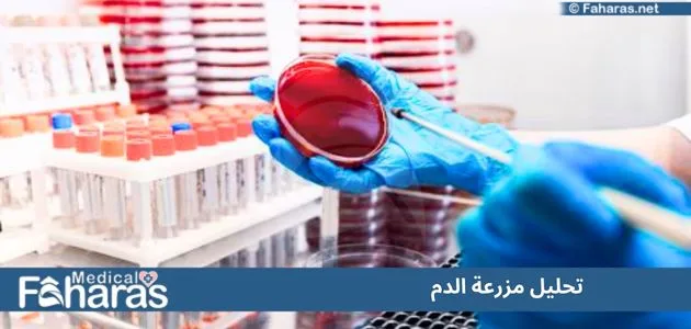 اختبار مزرعة الدم؛ دواعي إجراء التحليل ونتائج العينة المزروعة