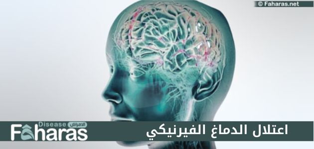 اعتلال الدماغ الفيرنيكي wernicke’s Encephalopathy؛ تعرف على الأسباب وطرق العلاج