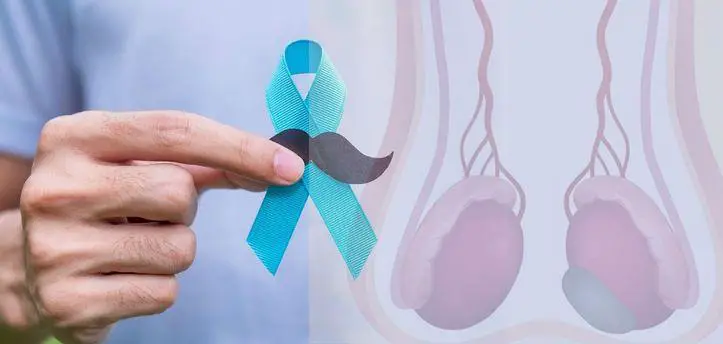 مرض سرطان الخصية (testicular cancer)؛ كل ما يهمك عنه